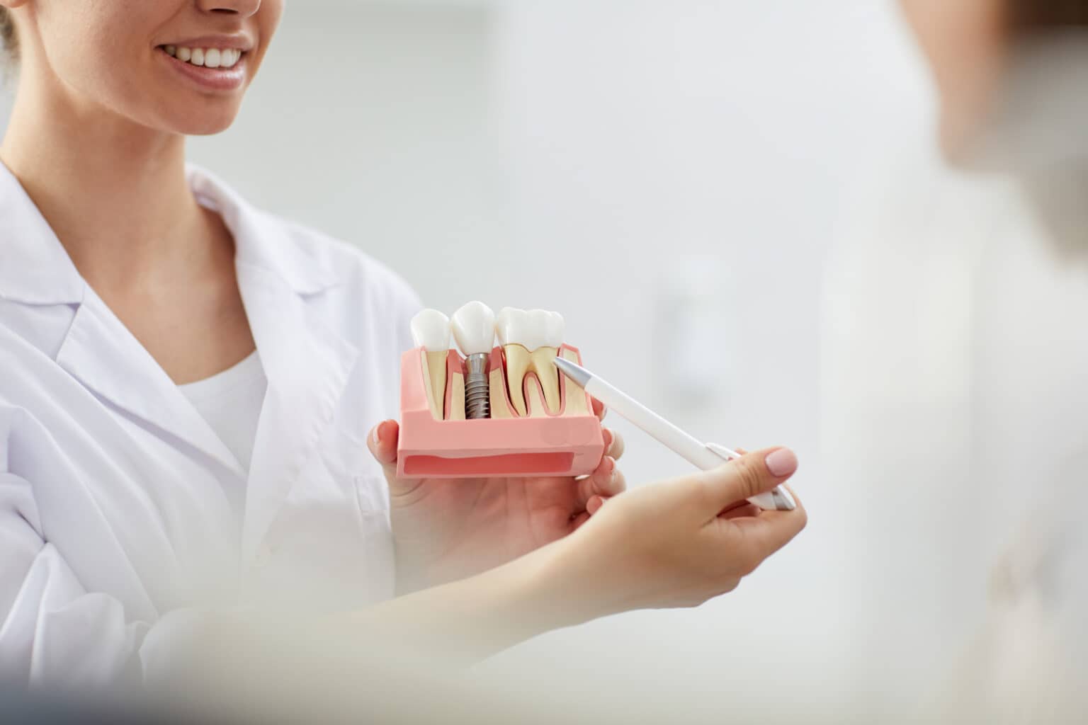 Dental Implants in Mississauga