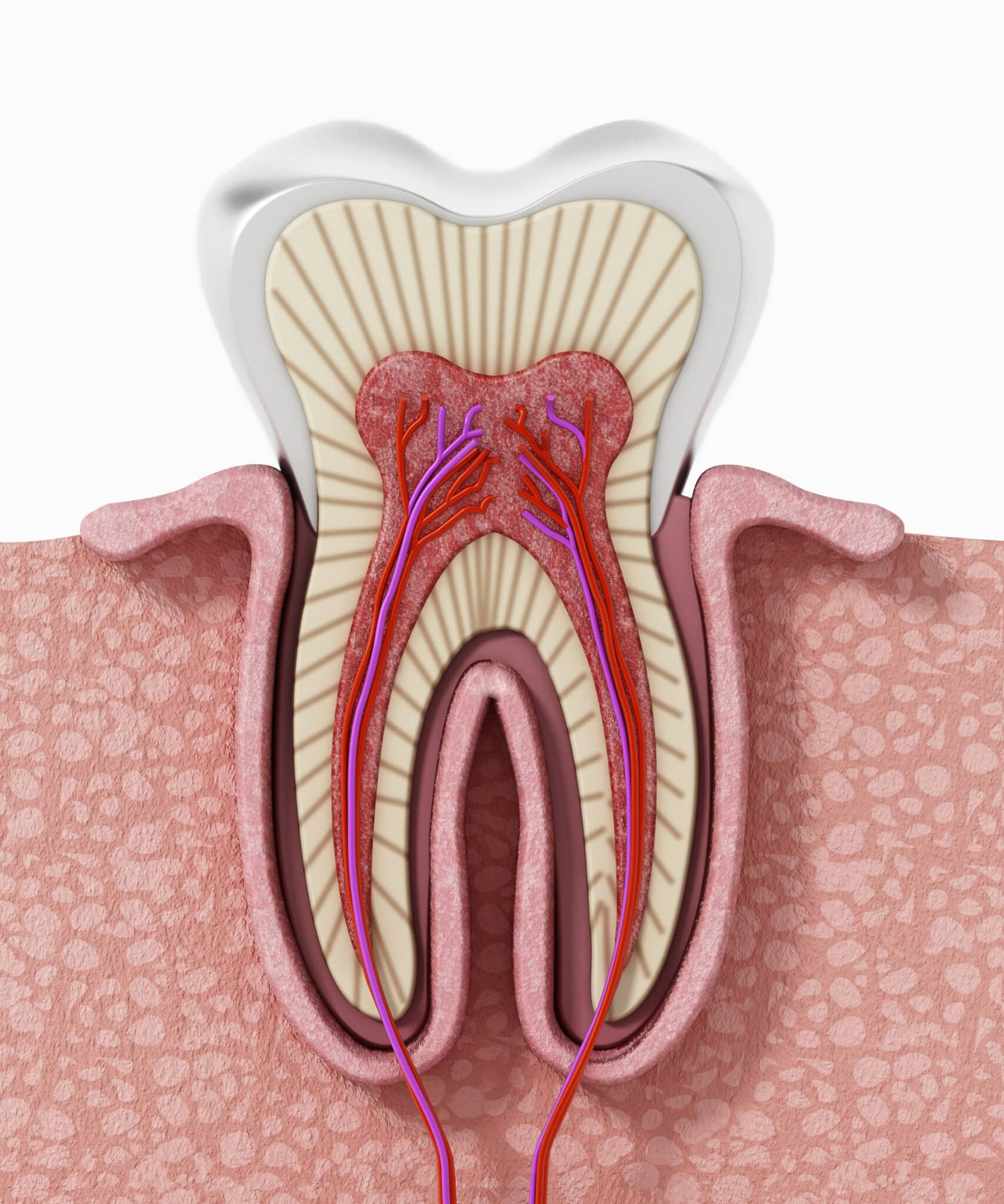 Root Canal Therapy in Mississauga