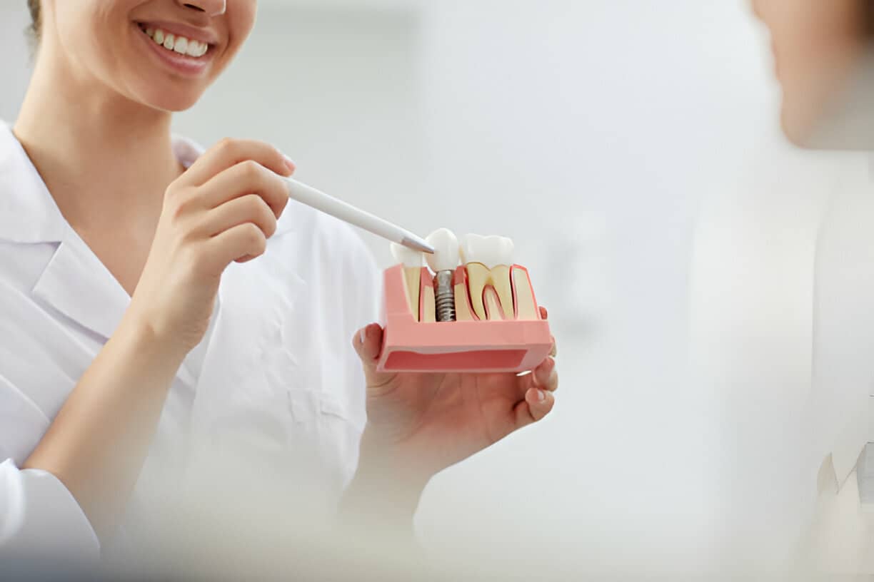 How to Choose the Right Dentist for Your Implant Needs?